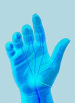 Синдром запястного (карпального) канала, онемение пальцев кисти